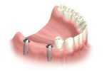 dentists, glebe, sydney, dental care, dentist, dental centre, dental, cosmetic dentist, cosmetic dentistry, Dental Care - Glebe, Sydney