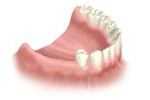 dentists, glebe, sydney, dental care, dentist, dental centre, dental, cosmetic dentist, cosmetic dentistry, Dental Care - Glebe, Sydney