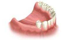 dentists, glebe, sydney, dental care, dentist, dental centre, dental, cosmetic dentist, cosmetic dentistry, Dental Care - Glebe, Sydney
