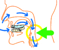 Sleep Apnea