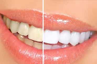 About Us - Dental Care, Glebe, Sydney, NSW, Australia