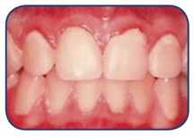 dentists, glebe, sydney, dental care, dentist, dental centre, dental, cosmetic dentist, cosmetic dentistry, Dental Care - Glebe, Sydney