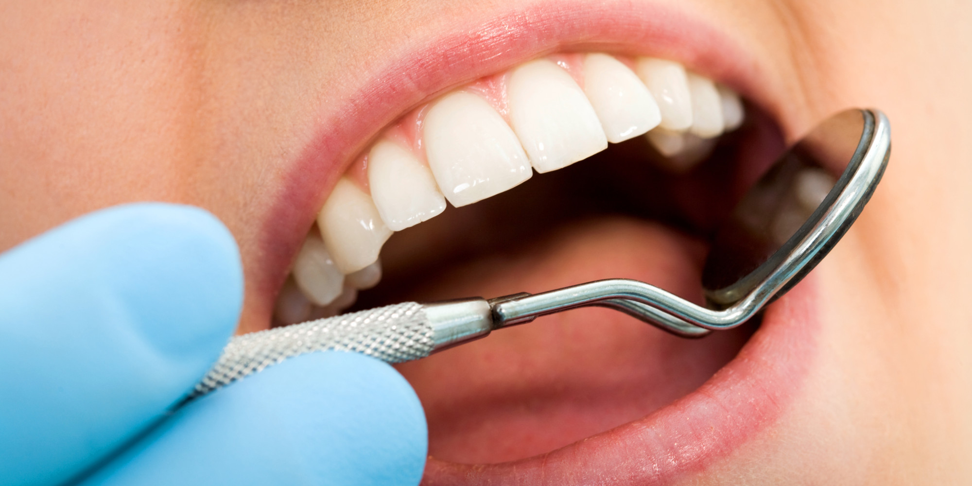 dentists, glebe, sydney, dental care, dentist, dental centre, dental, cosmetic dentist, cosmetic dentistry, Dental Care - Glebe, Sydney