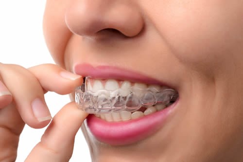 teeth whitening