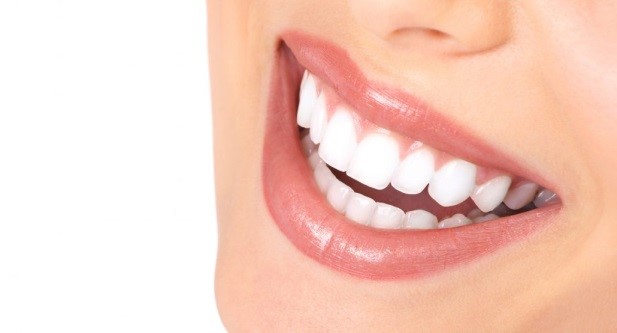 teeth whitening