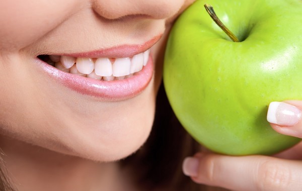Veneers