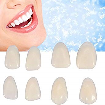 Veneers