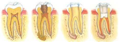 dentists, glebe, sydney, dental care, dentist, dental centre, dental, cosmetic dentist, cosmetic dentistry, Dental Care - Glebe, Sydney