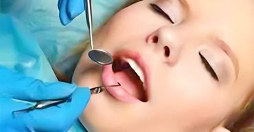 Young female patient undertaking dental treatment of wisdom teeth removal after receiving IV Sedation by the dentist at our same-day surgery sleep dentist near me