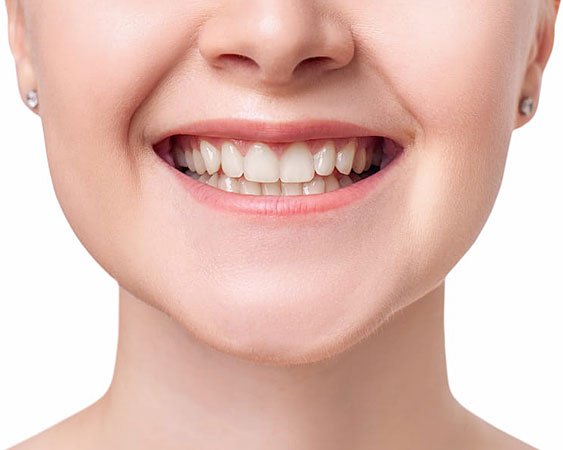 After Orthodontics 