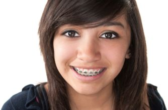 Emergency treatment @ Mosman Park Orthodontics, South of the River in Perth